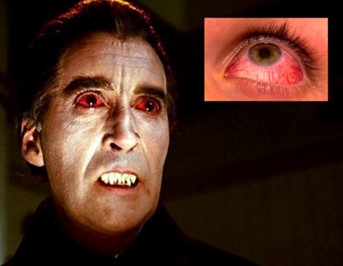 Christopher Lee em Dracula: Prince of Darkness (1966) e olho humano reagindo ao alérgeno.